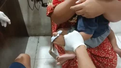 Jari Balita 3 Tahun Terjepit Seng, Damkar Jambi Turun Tangan